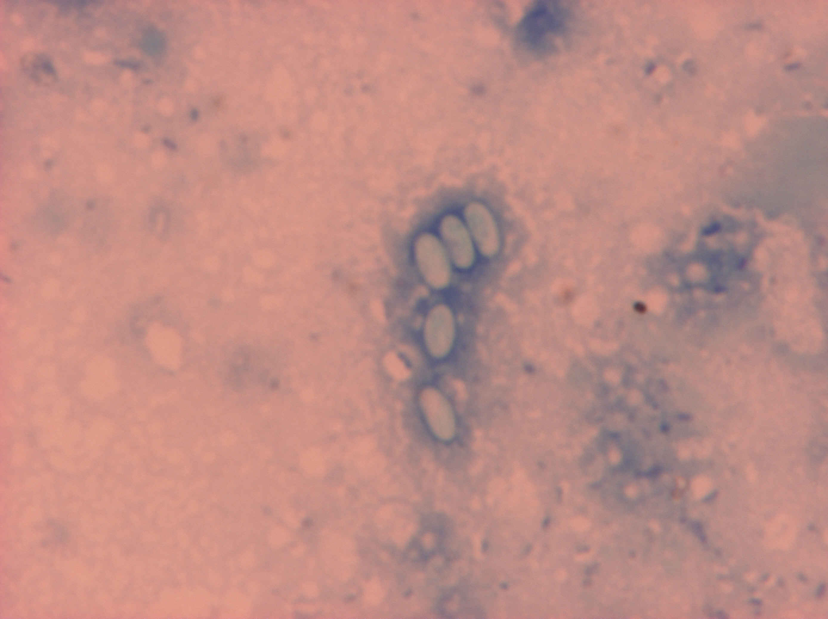 Esporas Nosema ceranae